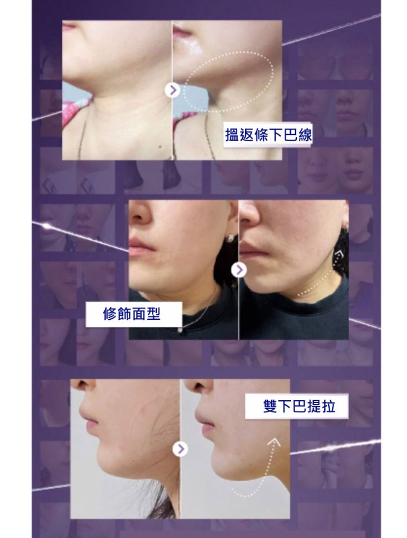 Numbuzin 9 Lifting-sil Full Face Mask 韓國 原廠正貨