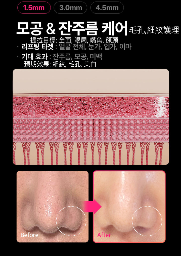 THERMATHERA 韓國無限發數 HIFU 美容儀 (1發10點)!!